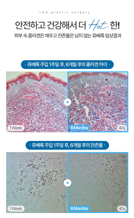 쥬베룩 이벤트로 피부 소생시키기 (효과, 주기, 가격)