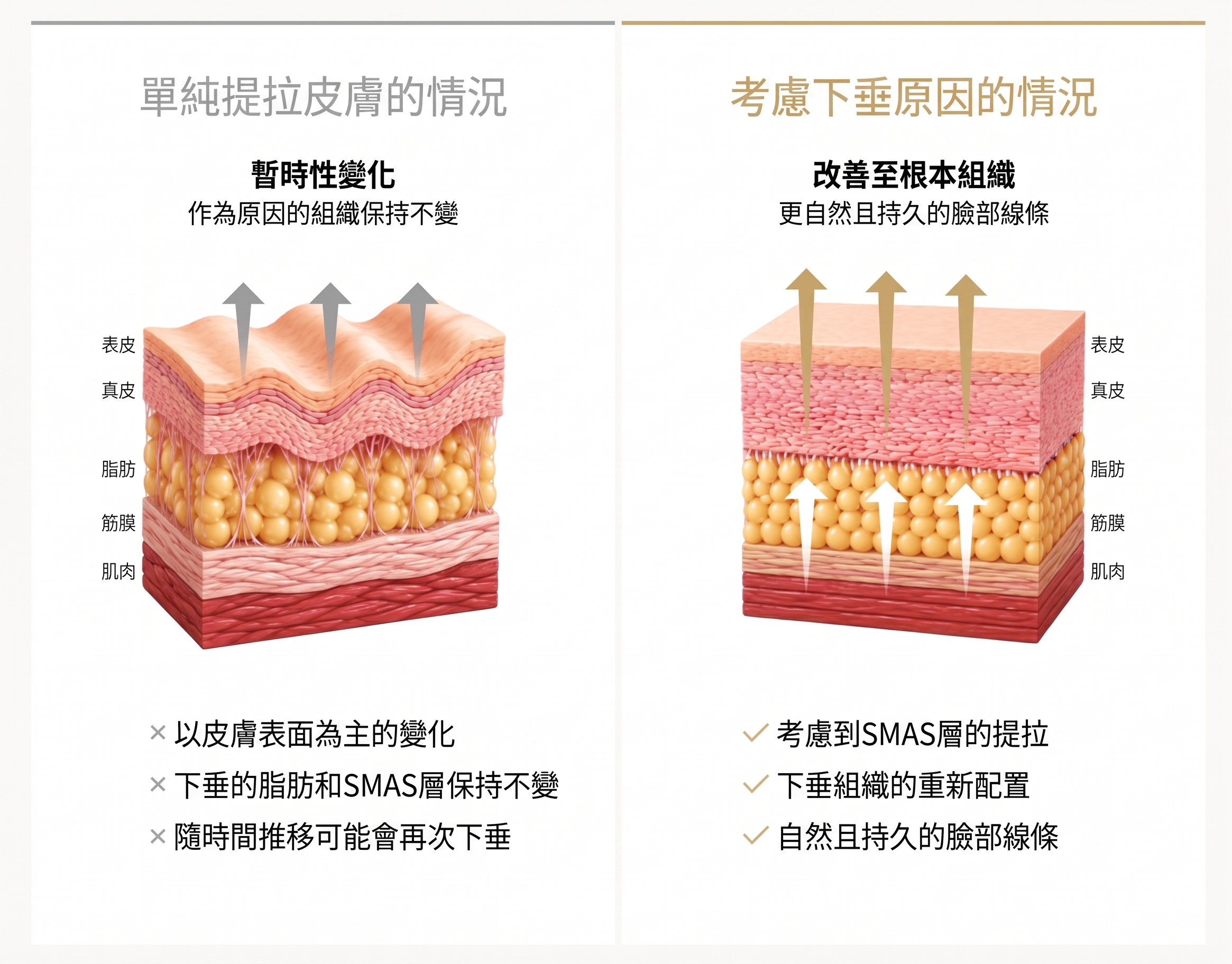 1mm整形外科 Facefit 微創拉皮 사진 4
