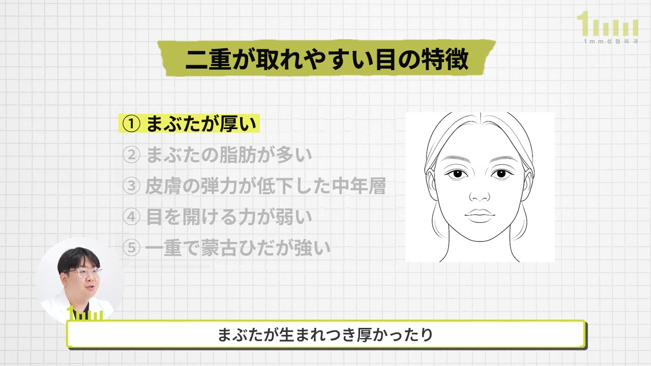方眼の背景に「二重が取れやすい目の特徴」というタイトルの下に5つの項目が並び、最初の項目「まぶたが厚い」に蛍光ペンが引かれ、右側に顔の線画、下に「まぶたが生まれつき厚かったり」という字幕が表示された動画画面