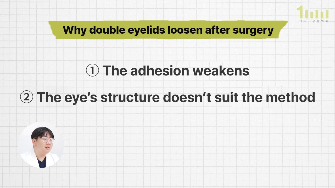 Video screen on a grid background with the title ‘Why double eyelids loosen after surgery’ and two lines, ‘① The adhesion weakens ② The eye’s structure doesn’t suit the method’, with a member of the medical team explaining in a circle at lower left