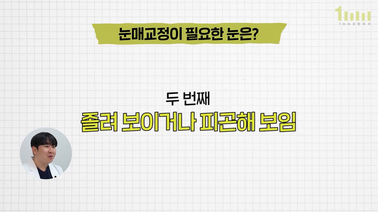 「눈매교정이 필요한 눈은?」 이라는 제목 아래 ‘두 번째 — 졸려 보이거나 피곤해 보임’ 이라는 문구가 적힌 영상 설명 화면