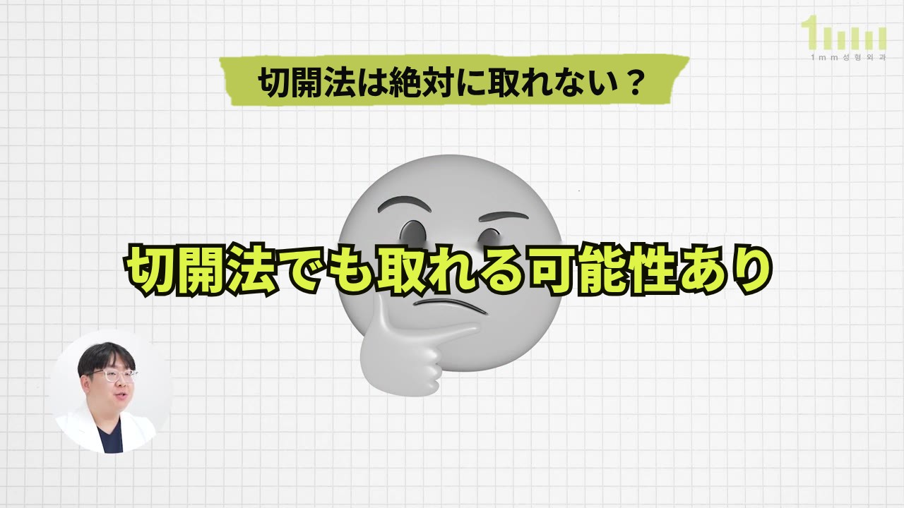 方眼の背景に「切開法は絶対に取れない？」というタイトルの下、灰色にぼかした考える顔の絵文字の上に「切開法でも取れる可能性あり」という蛍光色の大きな文字が置かれた動画画面