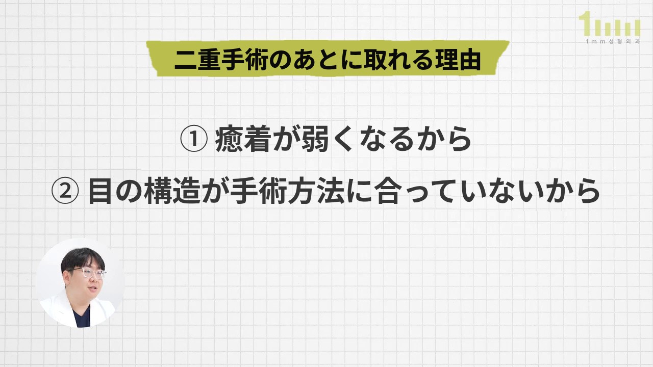 方眼の背景に「二重手術のあとに取れる理由」というタイトルと、「① 癒着が弱くなるから ② 目の構造が手術方法に合っていないから」という2行が書かれ、左下の円の中で医療スタッフが説明している動画画面