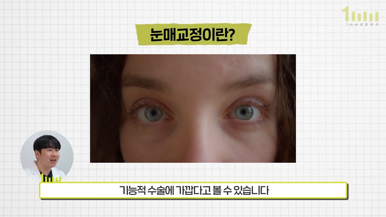 「눈매교정이란?」 이라는 제목 아래 두 눈을 크게 뜬 얼굴 클로즈업이 놓인 영상 설명 화면