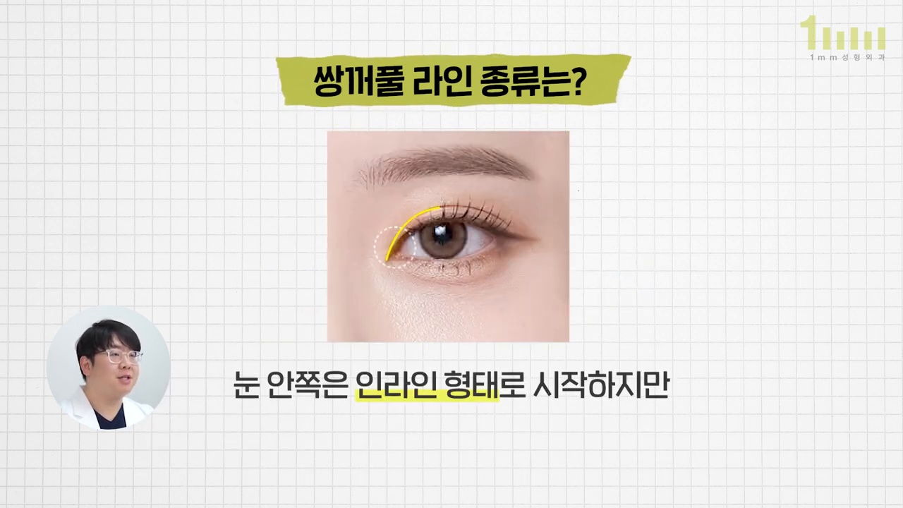 눈 앞머리 안쪽에서 시작하는 쌍꺼풀 라인이 노란 선으로 표시된 이미지와 ‘눈 안쪽은 인라인 형태로 시작하지만’ 이라는 영상 자막